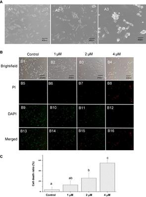 Protect Effects of Seafood-Derived Plasmalogens Against Amyloid-Beta (1–42) Induced Toxicity via Modulating the Transcripts Related to Endocytosis, Autophagy, Apoptosis, Neurotransmitter Release and Synaptic Transmission in SH-SY5Y Cells